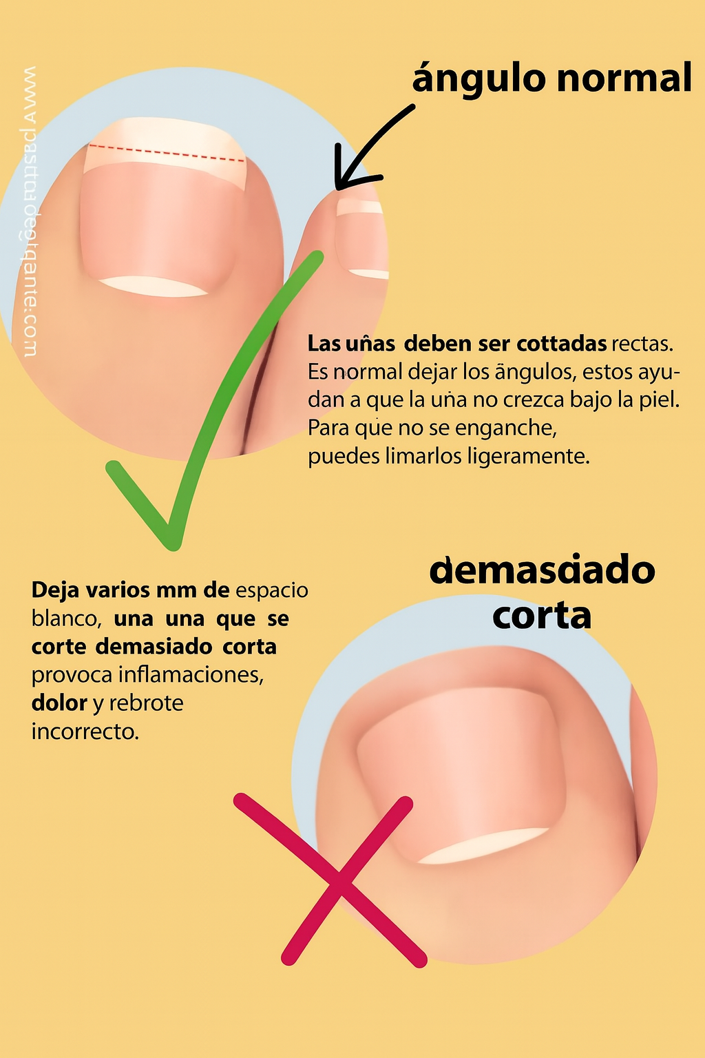 como cortar uñas bebe