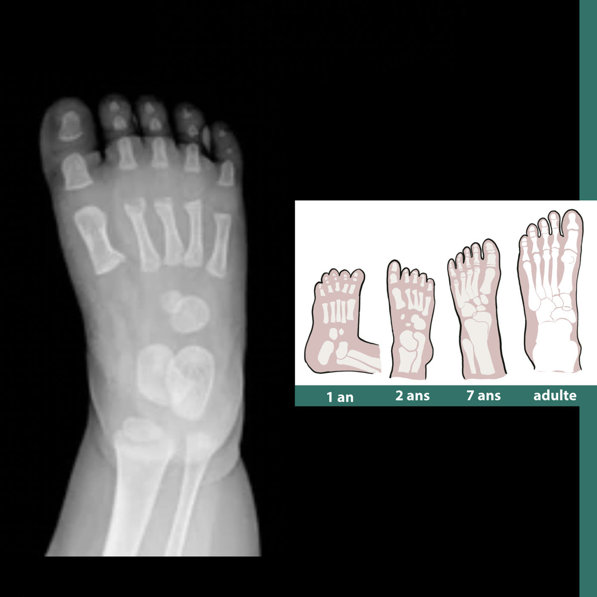 Quelle Est L anatomie Du Pied De B b Petits Pas De G ant quelle-est-l-anatomie-du-pied-de-b-b-petits-pas-de-g-ant