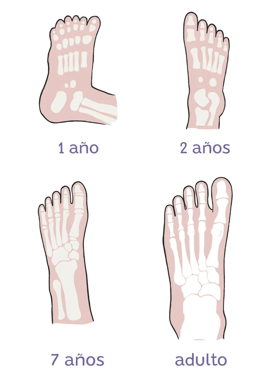 Radiología evolución pies niño con calzado respetuoso